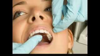 preview picture of video 'Burnsville Cosmetic Dentist'