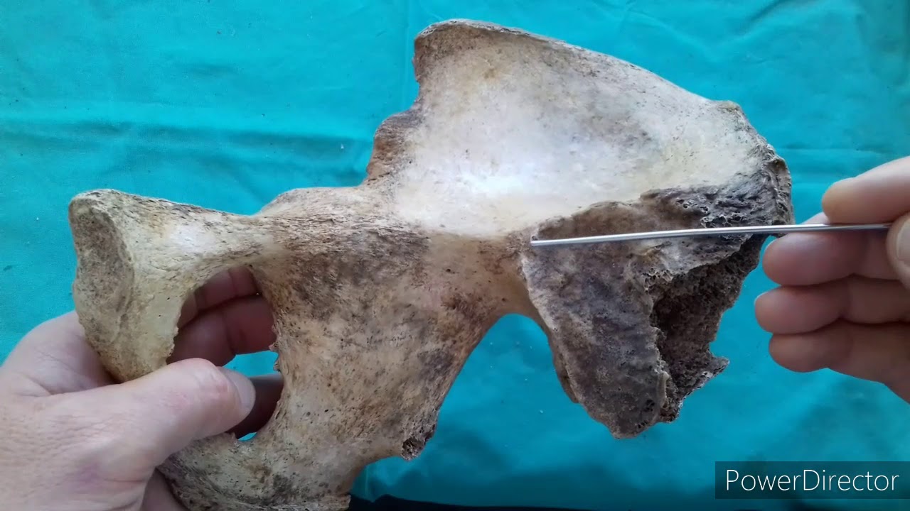 TP N° 10: Osteología del miembro inferior. Dr. Luciano Esborrat.