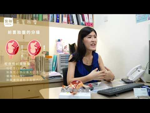 前置胎盤注意事項