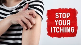 What Causes Hives and Itchiness - (Urticaria) Hives Treatment - Dr. Berg