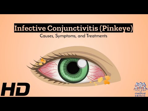 Effects of Cannabis on your body