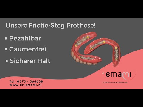 Frictie Steg in deutsch