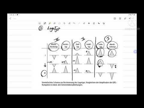 EKG Grundkurs mit EKG Beispiele