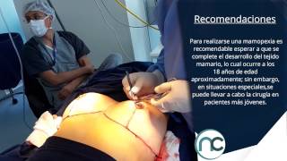 Reducción de senos (Mamopexia) - Dr. Nelson Chaves - Nelson Chaves
