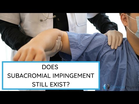 Does Sub-Acromial Impingement Still Exist?!?! | Expert reviews the CSAW Trial Research