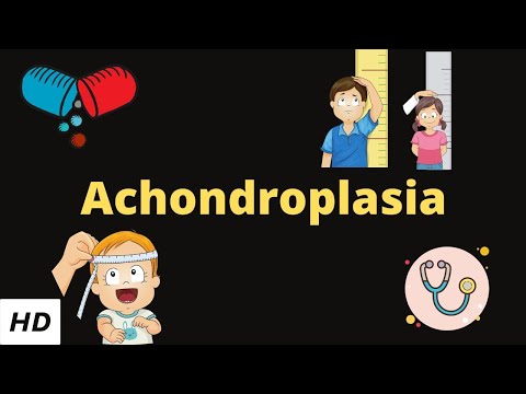 Achondroplasia, Causes, Signs and Symptoms, Diagnosis and Treatment.