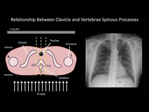 How to Interpret a Chest X-Ray (Lesson 3 - Assessing Technical Quality)