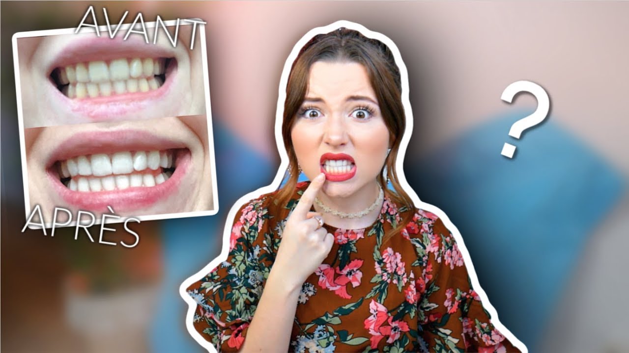 Watch video LA VERITE SUR LES BLANCHIMENTS DENTAIRES (douleur, prix, bbryance...) LA VERITE SUR LES BLANCHIMENTS DENTAIRES (douleur, prix, bbryance...)