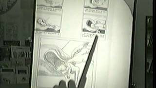 Dr. Llaila Afrika | Uterine Fibroid Tumors - Cause & Cure