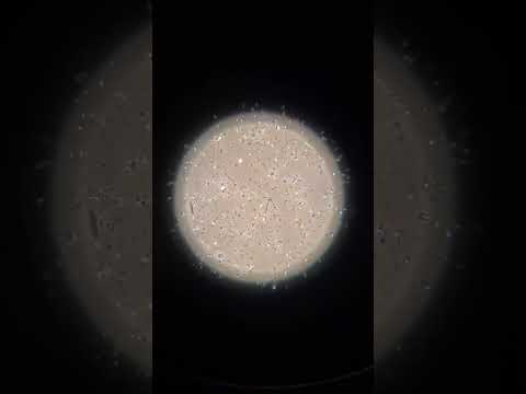 Sperm under a microscope