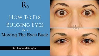 How To: Fix Bulging Eyes - Part 1 - Moving The Eyes Back