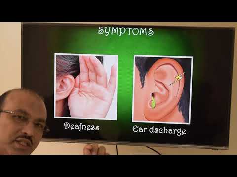 Keratosis obturans (Hindi) Patient teaching programme