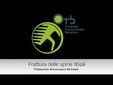 Lettere medici per le articolazioni Ernia nei sintomi del collo e trattamento
