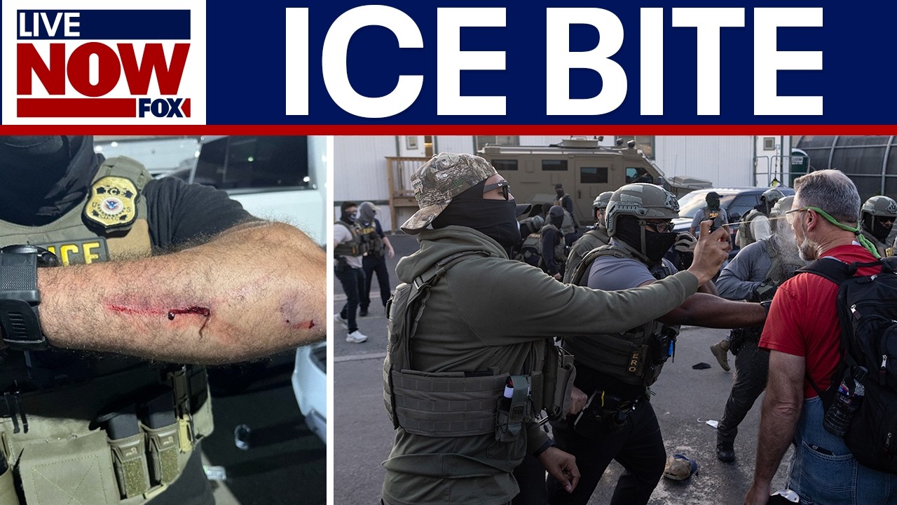Protester bites 2 ICE agents in Newark,  DOJ files charges