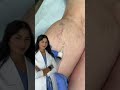 Sclerotherapy: what is it?!