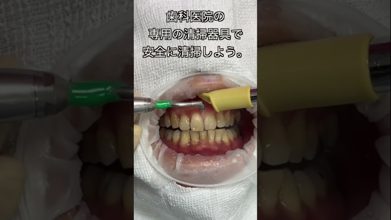 【戸塚駅前内藤歯科】クリーニングを受けましょう