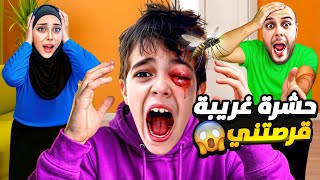 خلودة فاق عينو منفوخة و متورمة😨حشرة سامة قرصت عينو😱