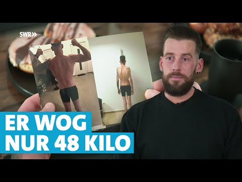 Magersucht: Krankheit kostete Thomas fast das Leben