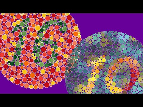 Ölmezdim - Güncel Gürsel Artıktay