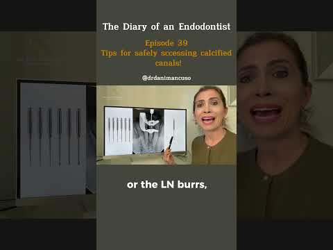 Tips for safely sccessing calcified canals!