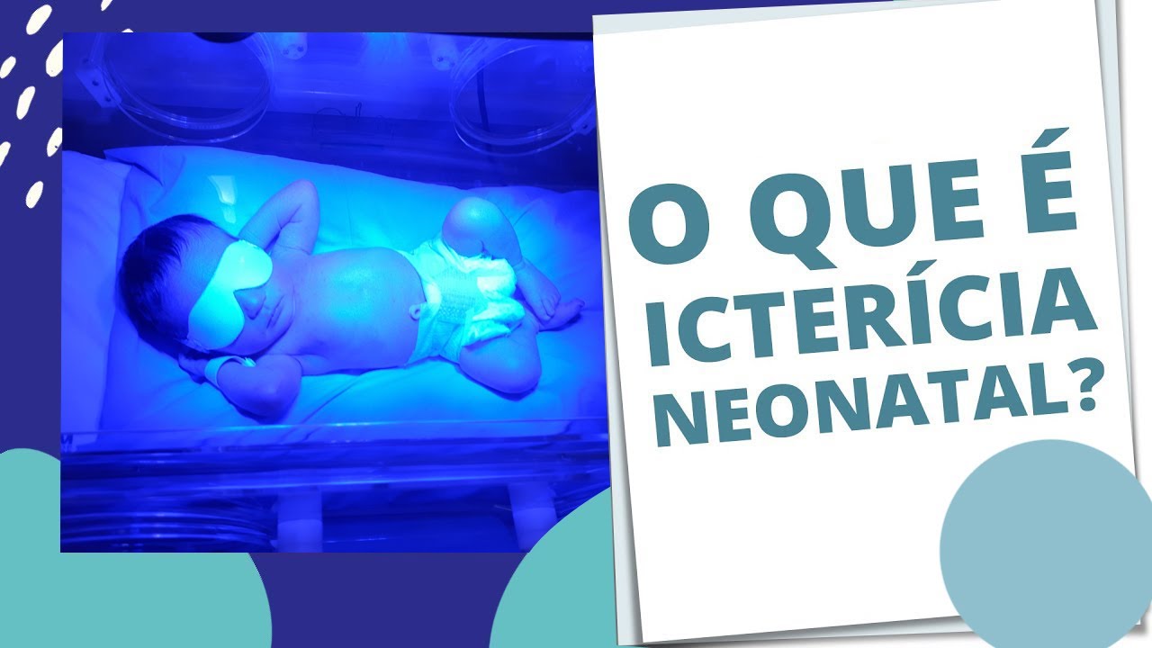 ICTERÍCIA NO RECÉM NASCIDO