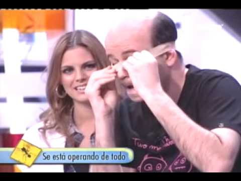EL HORMIGUERO: Jandro se opera de todo