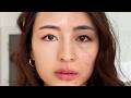 The Simple Skincare Routine That Saved My Skin