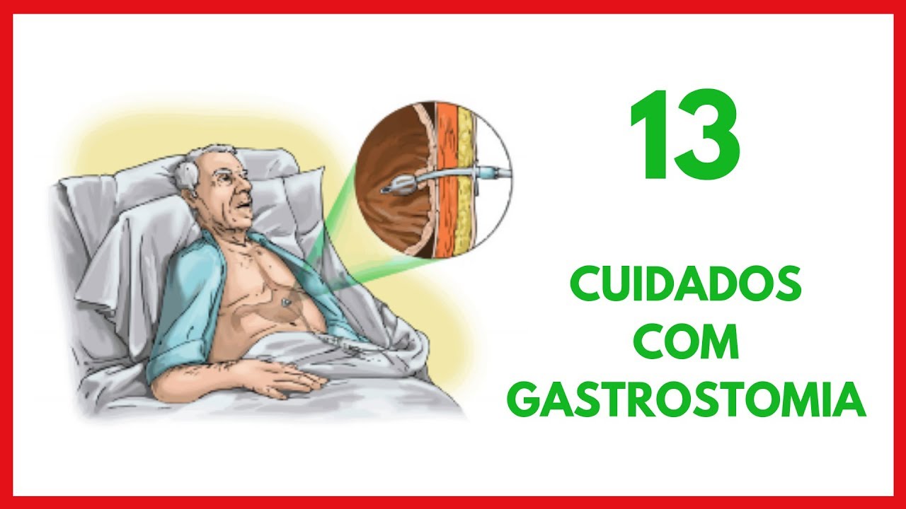 Cuidados de Enfermagem com Gastrostomia
