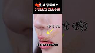 O-샷 성형 시술