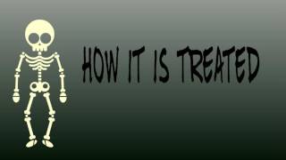 Depersonalzation/Derealization