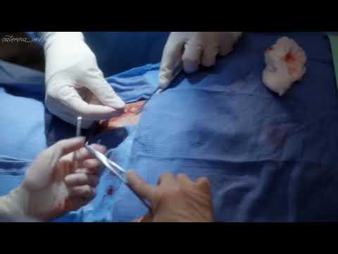 Grey's Anatomy 15x11 - Amelia Scene 7