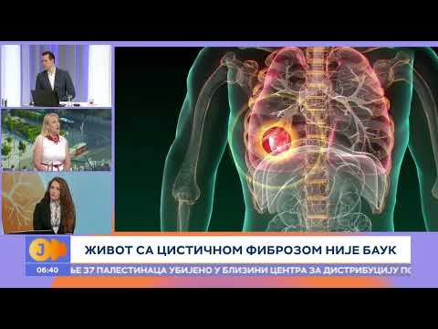 Cistična fibroza - terapija za normalan život | RTS Jutarnji program