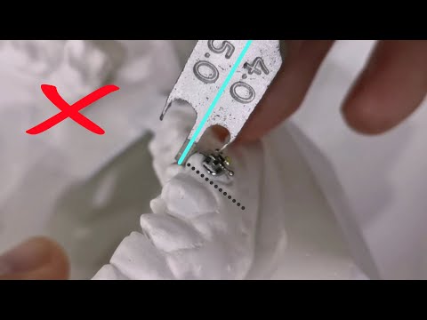 Bracket positioning, braces placement using height gauge