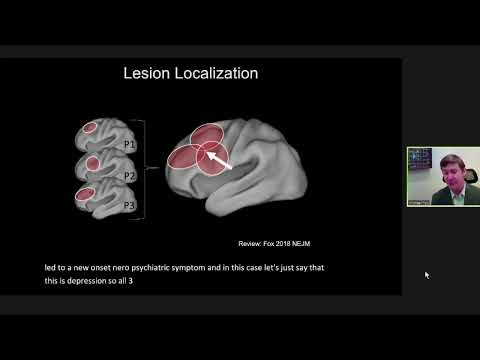 OHBM 2020 | Keynote | Michael Fox | From correlation to causal mapping of human brain function