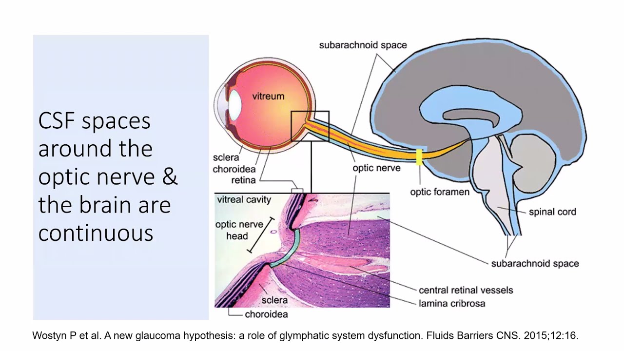 ICP (Intracranial Pressure) - WINFOCUS