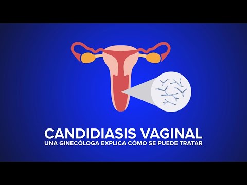 La Candidiasis: Tipo de infecci&oacute;n vaginal