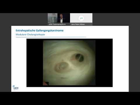 Viszeralonkologisches Kolloquium: Bedeutung der Endoskopie in der Viszeralonkologie