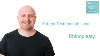 Rhinoplasty Patient Testimonial - Luca