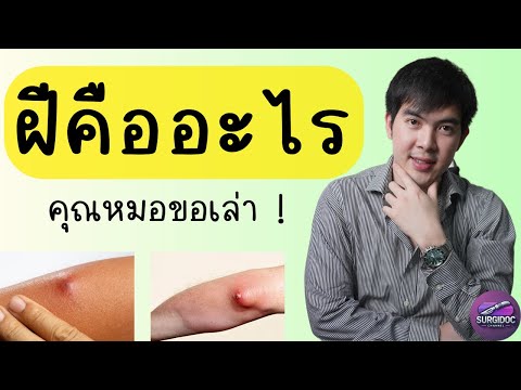 ฝีหรือหนอง คืออะไร ? สรุปสั้นเข้าใจง่ายจบใน 15 นาที l SURGIDOC EP.39