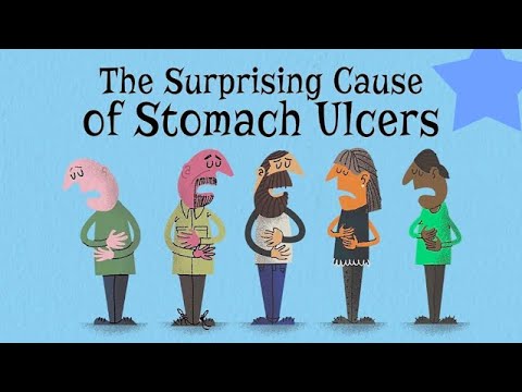 The Surprising Cause of Stomach Ulcers || Amazing Healthy Corner