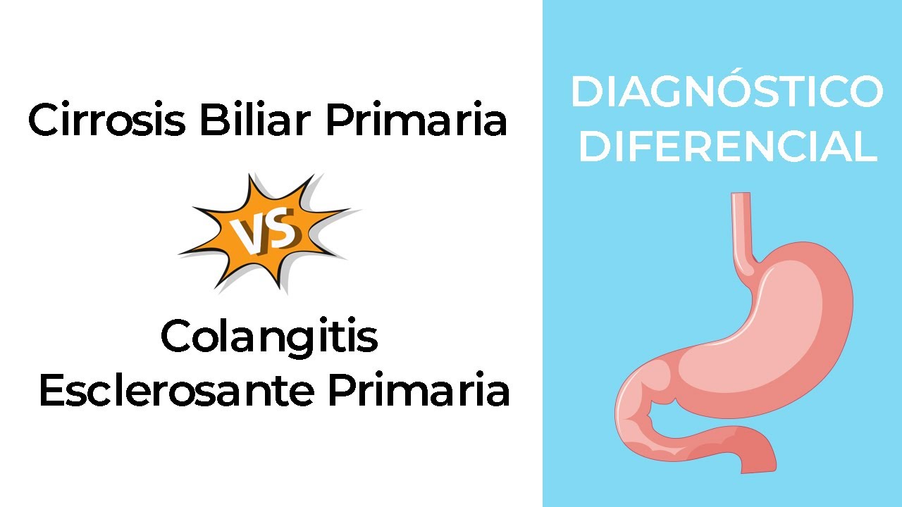Diagnóstico Diferencial. Cirrosis Biliar Primaria vs Colangitis Esclerosante Primaria