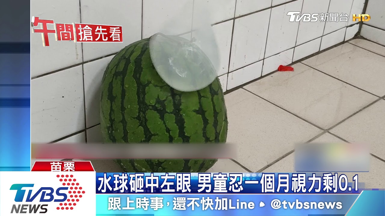 水球砸中左眼 男童忍一個月視力剩0.1