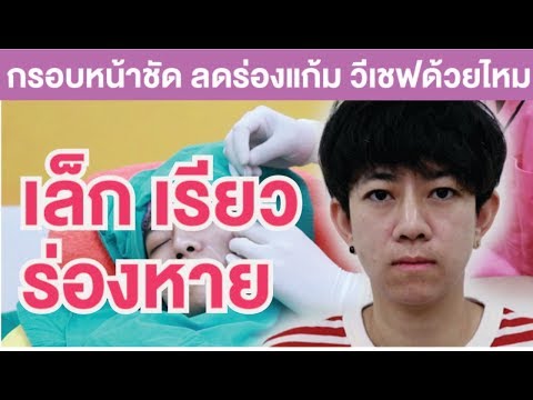 ร้อยไหม