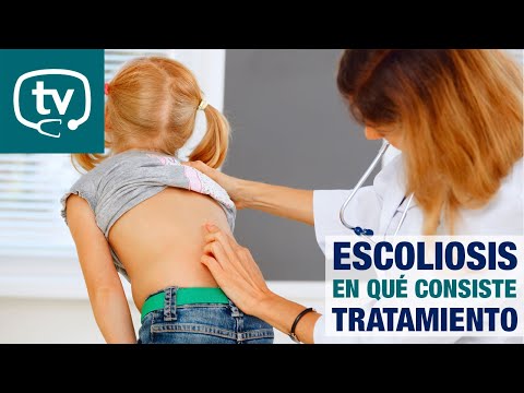 ¿Qué es la escoliosis?