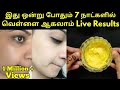 Get Fair Skin Within 7 Days Live Result Anu Rii Tamil