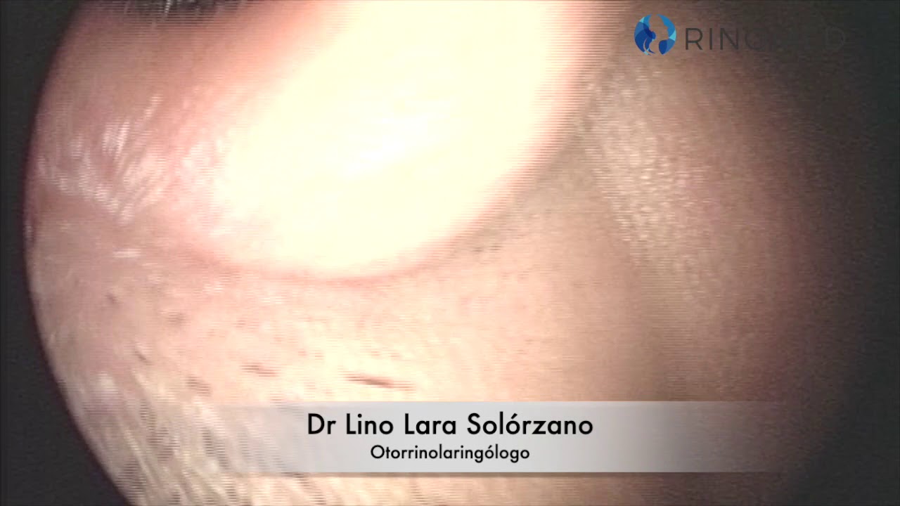 Lino Lara Solórzano-8