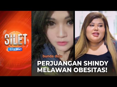 SOSOK VIRAL! Shindy Samuel Banyak Lakukan Diet & Operasi | SILET