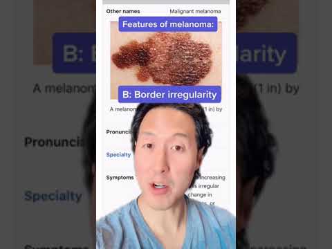 So erkennen Sie, ob Sie ein Melanom haben! #shorts #Hautkrebs