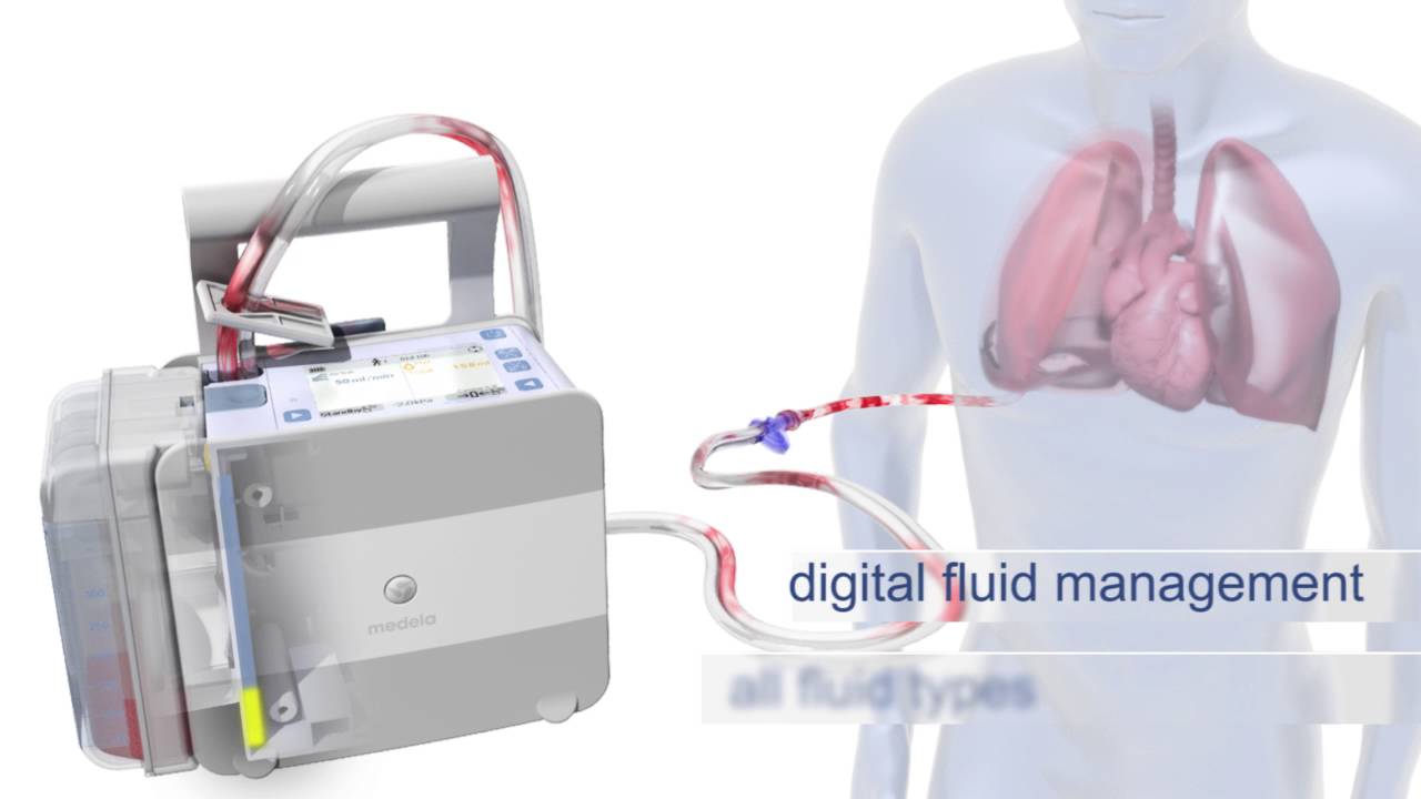 Thopaz+ digital chest drainage system Cardiothoracic drainage Medela