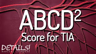 ABCD2 Score for Transient Ischemic Attack (TIA) | Details